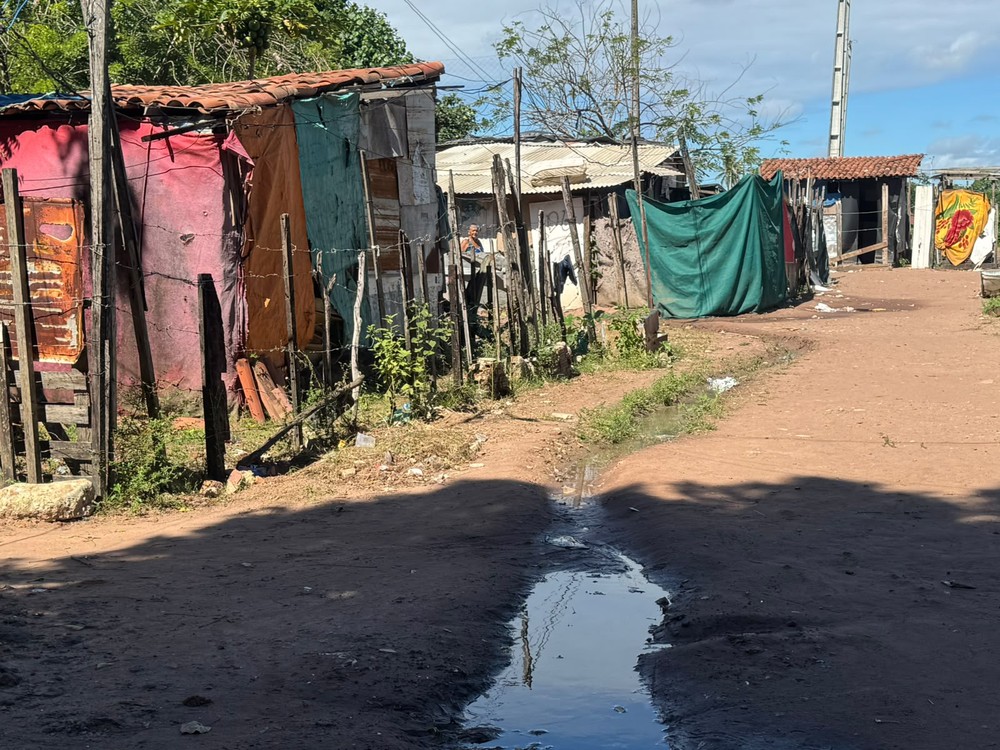Surto de 'bicho-de-pé' atinge cerca de 100 crianças no RN