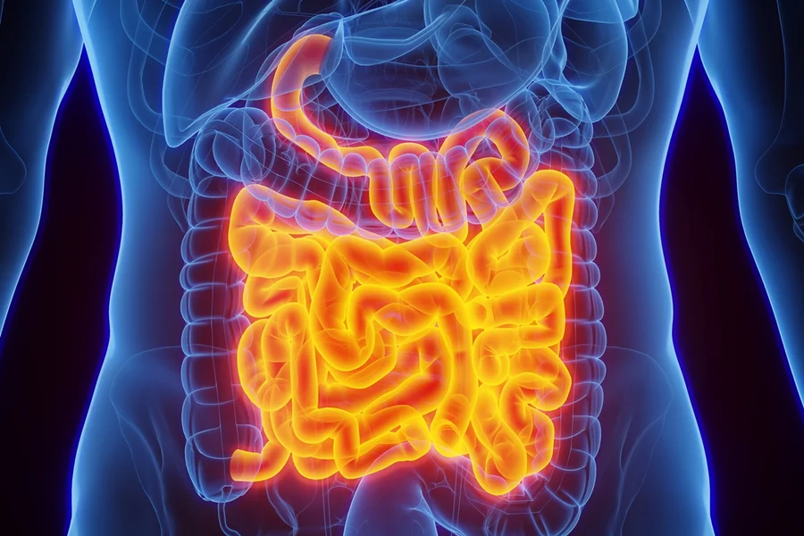 Sintomas que podem ser causados pela síndrome do intestino irritável